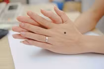 Bàn tay có nốt ruồi ở vị trí này là người có vận khí đại cát
