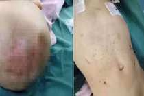 Bé 3 tuổi qua đời thương tâm, lý do đằng sau ai ai cũng phẫn nộ