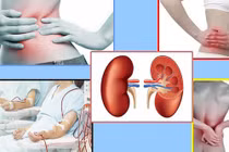 Dấu hiệu nhận biết có thể bị suy thận, thậm chí là chứa khối u
