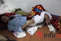 Mẹ nóng giận “lỡ tay” xô con vào đống lửa