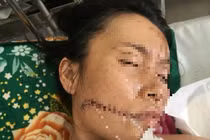 Uẩn khúc phía sau vụ người đàn ông phóng hỏa đốt nhân tình rồi tự thiêu