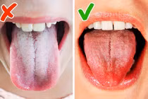 Thấy cơ thể phát đi tín hiệu này, hãy nhanh chân đi gặp bác sĩ 