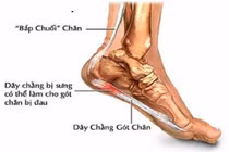 Triệu chứng báo hiệu bệnh viêm khớp