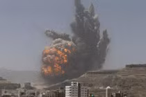 Cuộc chiến tàn khốc ở Yemen qua hình ảnh