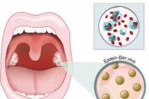 Một số bệnh do virus lây truyền qua nụ hôn