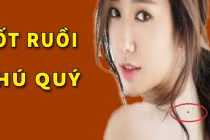 3 nốt ruồi tượng trưng cho Tài - Lộc - Phát, ai được 1/3 cũng hạnh phúc