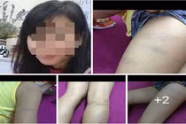 Bắc Ninh: Giáo viên chủ nhiệm đánh học sinh dã man?