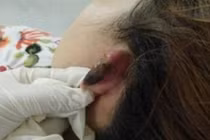 Kinh hoàng: Thiếu nợ tiền, gái trẻ bị hành hung...cắt lỗ tai