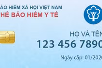 Dùng thẻ BHYT điện tử, định dạng bằng khuôn mặt từ tháng 1/2020