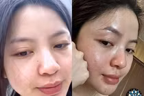 Vợ Quang Hải liên tục xuất hiện với thần sắc kém, lộ khuyết điểm