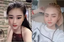 Hot trend môi cánh én biến dạng, chị em nghiện "dao kéo" rần rần chạy theo 