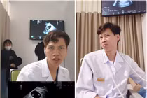 Bác sĩ siêu âm thai hot TikTok gây chú ý với biểu cảm 