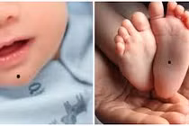 Trẻ có 1 trong 7 nốt ruồi này: Tương lai sáng chói, ắt làm quan 
