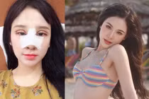 Yến Tatoo lên đời nhan sắc sau 5 năm phẫu thuật thẩm mỹ
