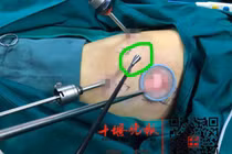 Bé gái 8 tuổi suýt mất mạng, bác sĩ phát hiện thứ khủng khiếp