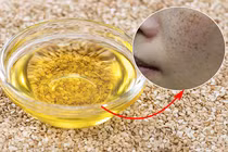 Mách bạn cách chăm sóc da cực kỳ đơn giản, không tốn kém
