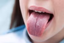 Lưỡi có thể tiết lộ tình trạng sức khỏe đang gặp vấn đề gì? 