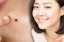Người có 1/6 nốt ruồi này càng già càng giàu có, con cháu thịnh vượng đời đời