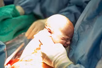 Xúc động khoảnh khắc bé chào đời qua đường mổ
