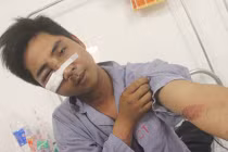 141 Hà Nội bị “tố” đánh gẫy xương gò má người dân