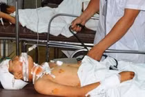 Nổ đạn kinh hoàng, 8 học sinh thương vong
