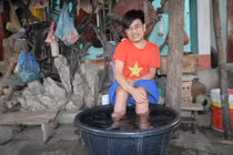 Cậu bé chân nóng như lò than chữa khỏi ung thư (?)