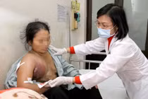 “Nổ” khối u vì chữa ung thư bằng thuốc Nam