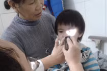 Bé bỏng mắt vì nghịch gói hút ẩm