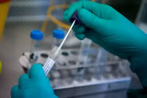 Test nhanh dương tính COVID-19…RT-PCR lại âm tính, sao vẫn cần xét nghiệm nhanh?