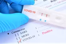 Làm thế nào hạn chế "dương tính giả" khi test nhanh COVID-19?