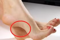 Bạn có số giàu sang hay bần hàn nhìn chân rõ ngay!