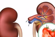 Gặp 6 dấu hiệu này sau khi ăn cà chua thì nên hạn chế lại ngay