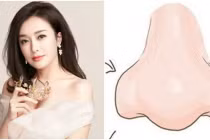 Trên mặt xuất hiện 5 dấu hiệu khác thường, chủ nhân cẩn trọng kẻo ốm đau