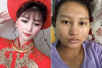 Nhan sắc tàn tạ khi sinh nở, cô gái được chồng chuyển tiền đền bù