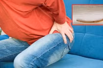 Người đàn ông đi khám mới phát hiện xương cá mắc ở hậu môn