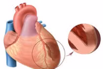 Huyết áp cao có nguy hiểm không?