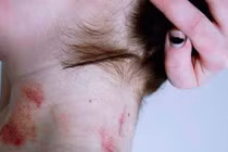 Điểm lại các trào lưu ngớ ngẩn của giới trẻ châu Á
