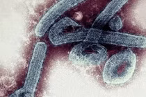 WHO xác nhận một loại virus chết người ở Ghana, có thể gây tử vong tới 90%