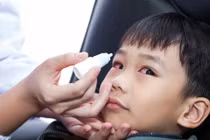 Triệu chứng đau mắt đỏ phổ biến ở trẻ
