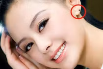 Phụ nữ sở hữu nốt ruồi này, coi chừng... giàu mất gỡ