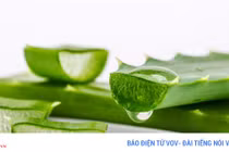 Mẹo chữa bỏng nắng đơn giản tại nhà