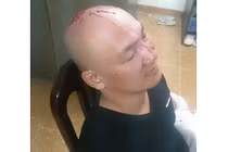 Va quệt xe, thanh niên cầm dao lao vào ẩu đả