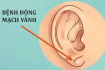 13 dấu hiệu bệnh tật ngỡ là điều bình thường