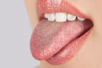Video: Tự chuẩn bệnh chính xác 90% chỉ cần nhìn màu lưỡi