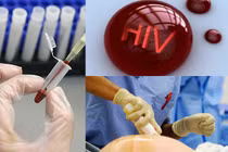 Những vụ công an, bác sĩ phơi nhiễm HIV kinh hoàng nhất VN