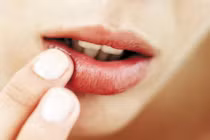 Nhìn màu môi chẩn đoán tình trạng sức khỏe