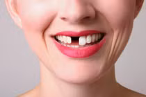 Những thói quen nguy hại khiến răng biến dạng khủng khiếp
