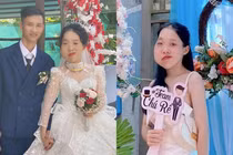 Cô gái mặt lệch từng bị chê ngoại hình, giờ chồng cưng hết mực