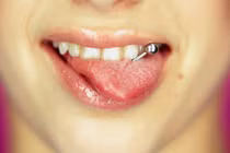 Những thói quen xấu phá hỏng hàm răng