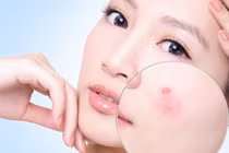 Nên dùng máy rửa mặt hay không? Đây là lời khuyên của chuyên gia